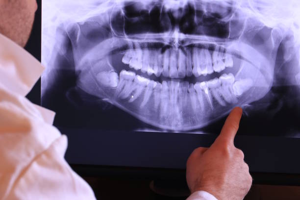 Best Emergency Dental Surgery in White Marsh, MD